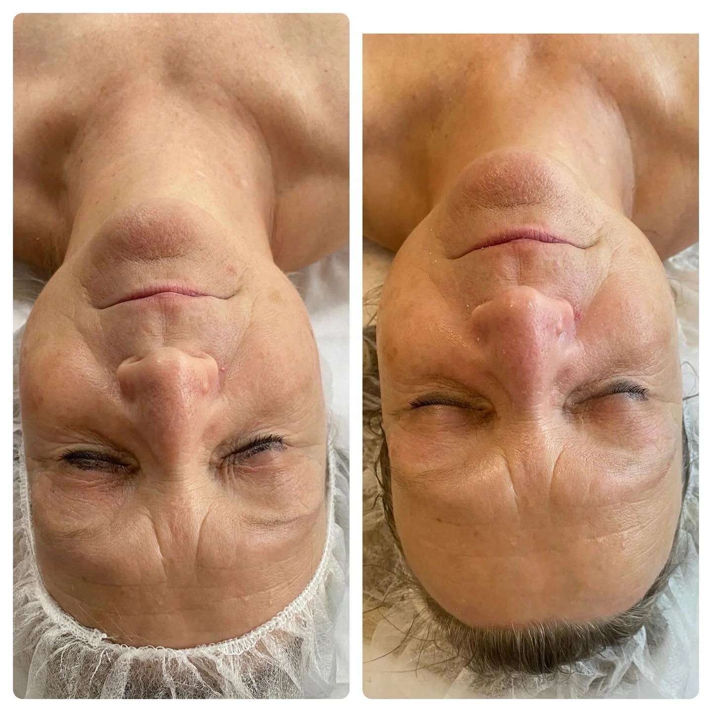 Diamant Lift, anti-aging Behandlung 🥰