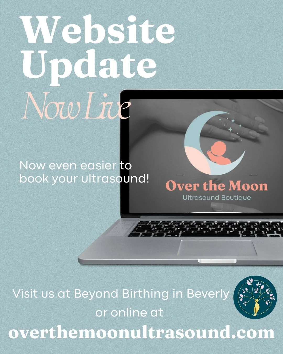 Our friends at @overthemoonultrasound have totally upgraded their website -making it easier to explore our ultrasound packages, learn more about their services, and book your appointment in just a few clicks.
If you&rsquo;ve been thinking about sched