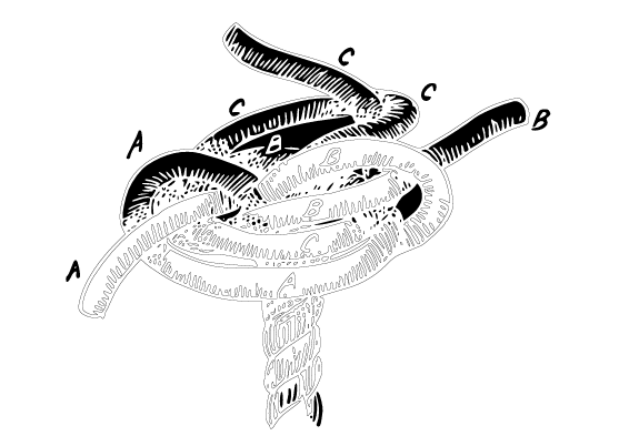 Black and white illustration of a twisted, segmented object resembling a knot or a tangled loop with labeled parts A, B, and C.