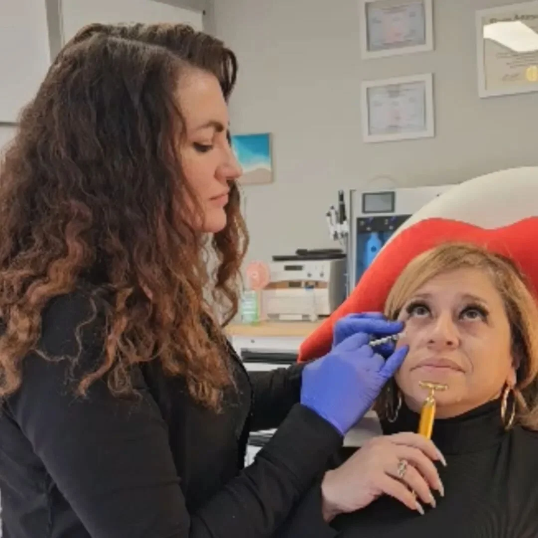 Jelly Rolls

By strategically injecting Botox&reg; into the specific muscles surrounding the lower eyelid area, the goal is to relax the muscles and reduce the appearance of the rolled or puffy effect.