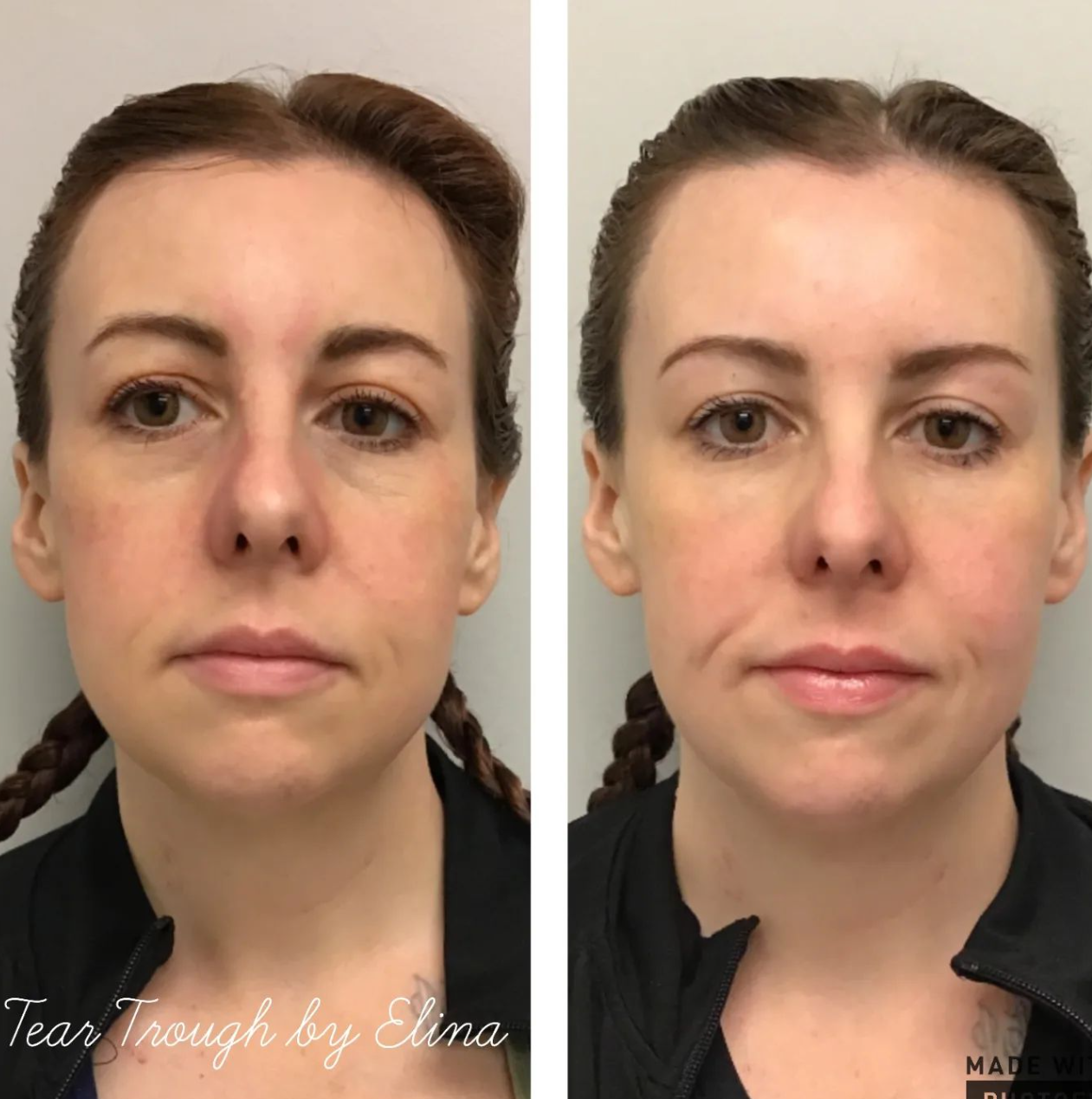 Alexis Lynds b4 after.png