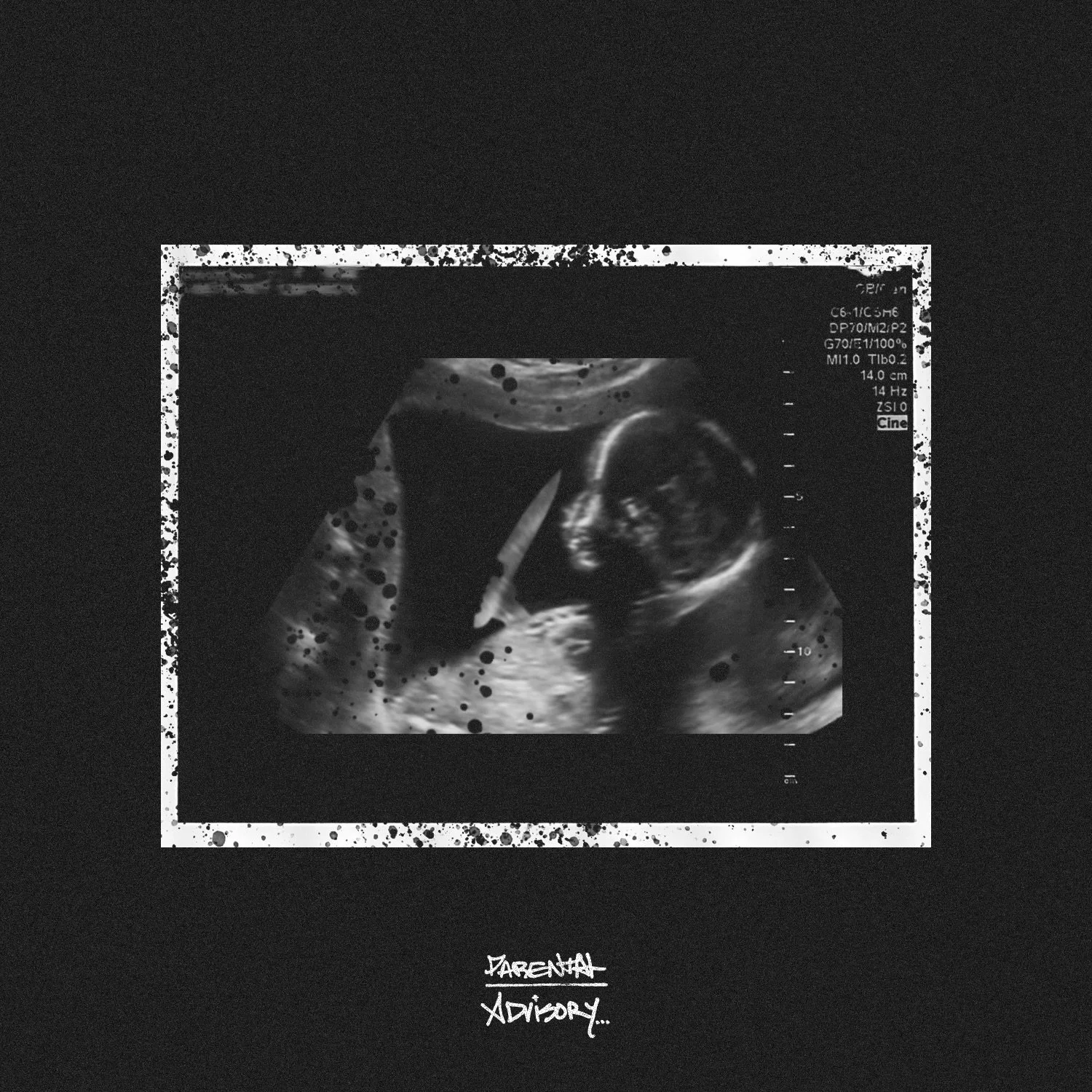 “Natural Born Killa” - Ivory Keyes: A Left-Field, Heavy-Hitting Rap Anthem