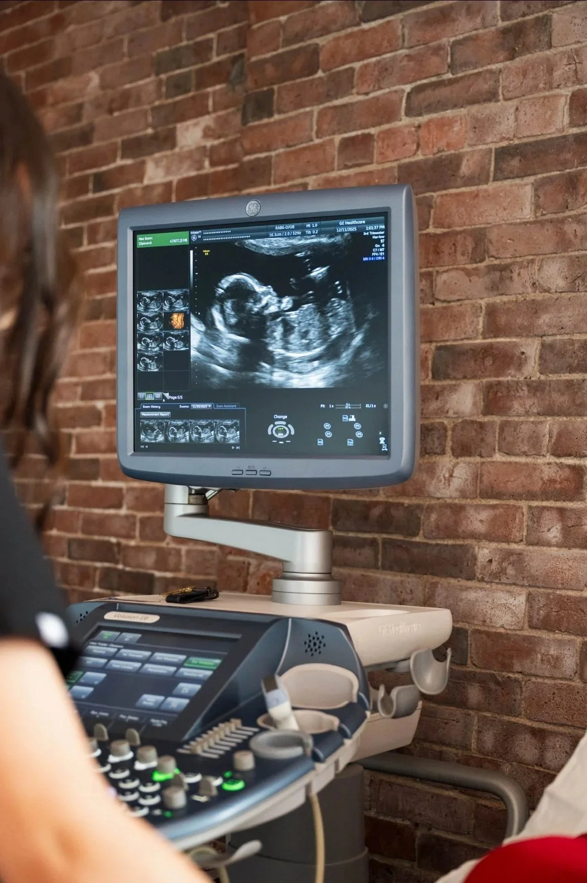 Couple holding a 2D ultrasound picture together. 
