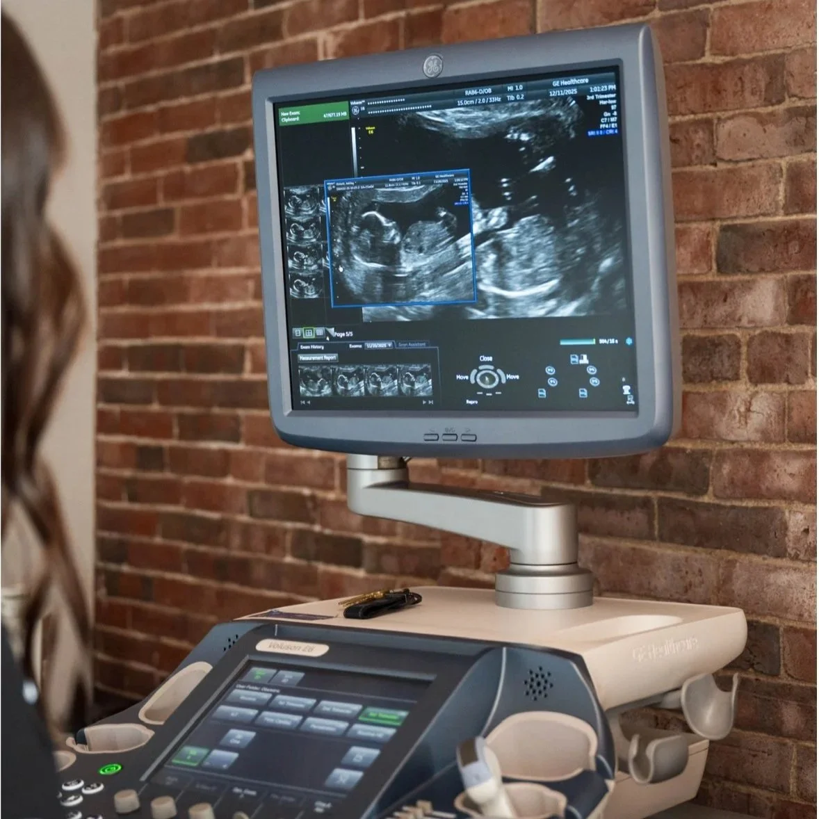 Ultrasound machine displaying a prenatal ultrasound image inside a professional elective ultrasound studio.