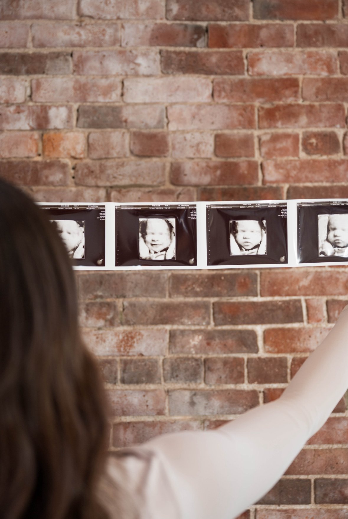 A doctor and a nurse observing a 3D ultrasound of a fetus on a monitor in a hospital room.