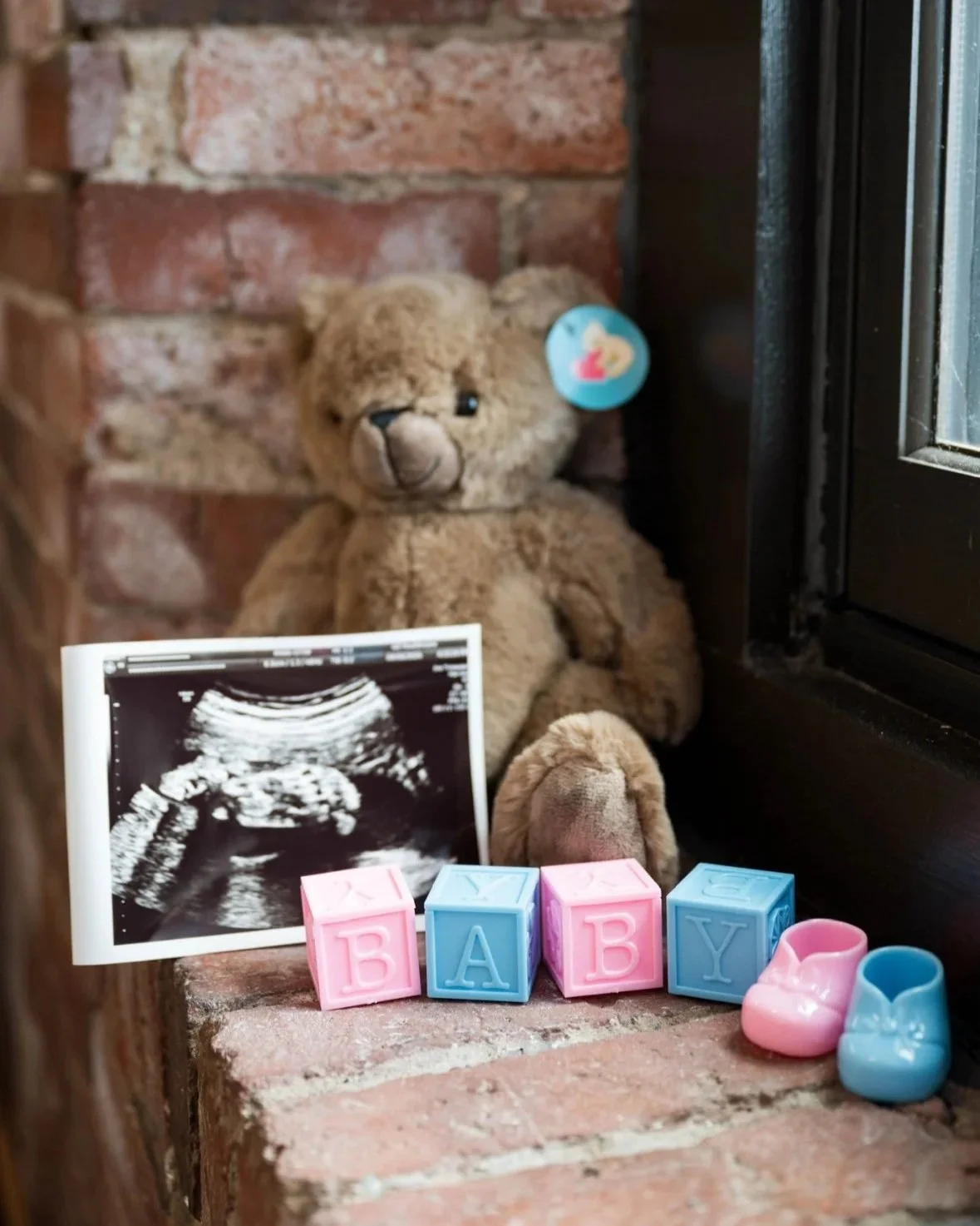 Printed prenatal ultrasound photo displayed with baby blocks spelling ‘BABY’ and a plush teddy bear inside an elective ultrasound studio.