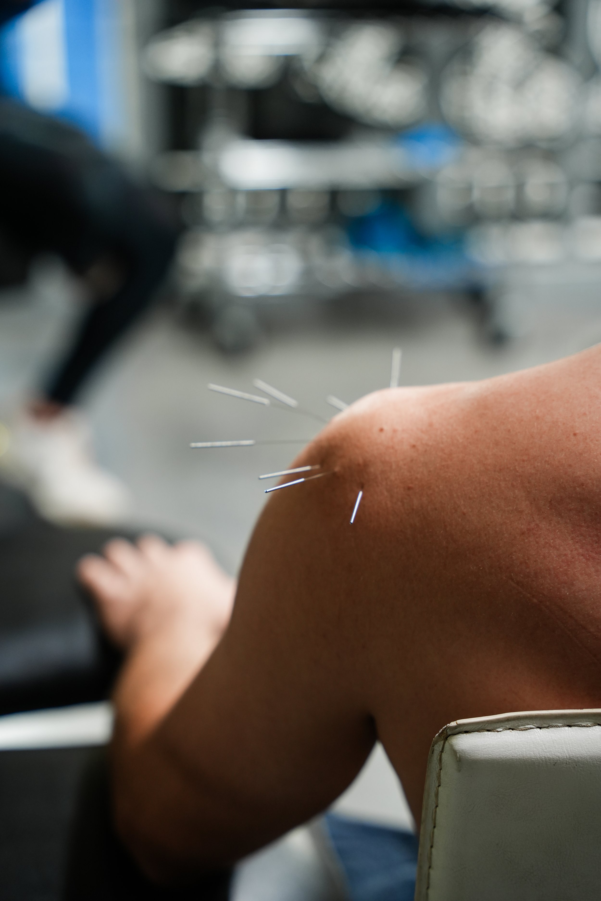 When to See a Physical Therapist for Shoulder Pain: Signs You Shouldn’t Ignore