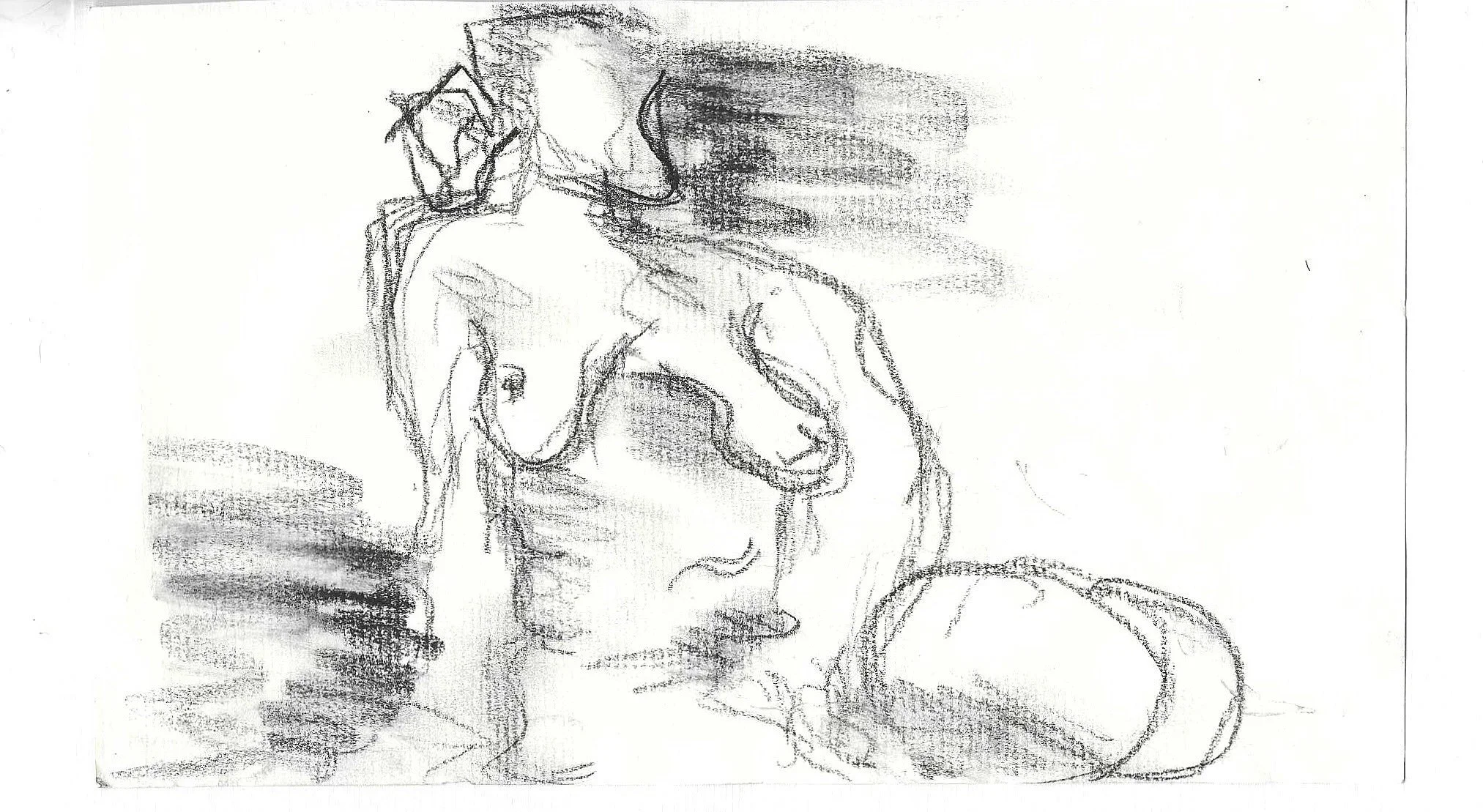 soft tissue