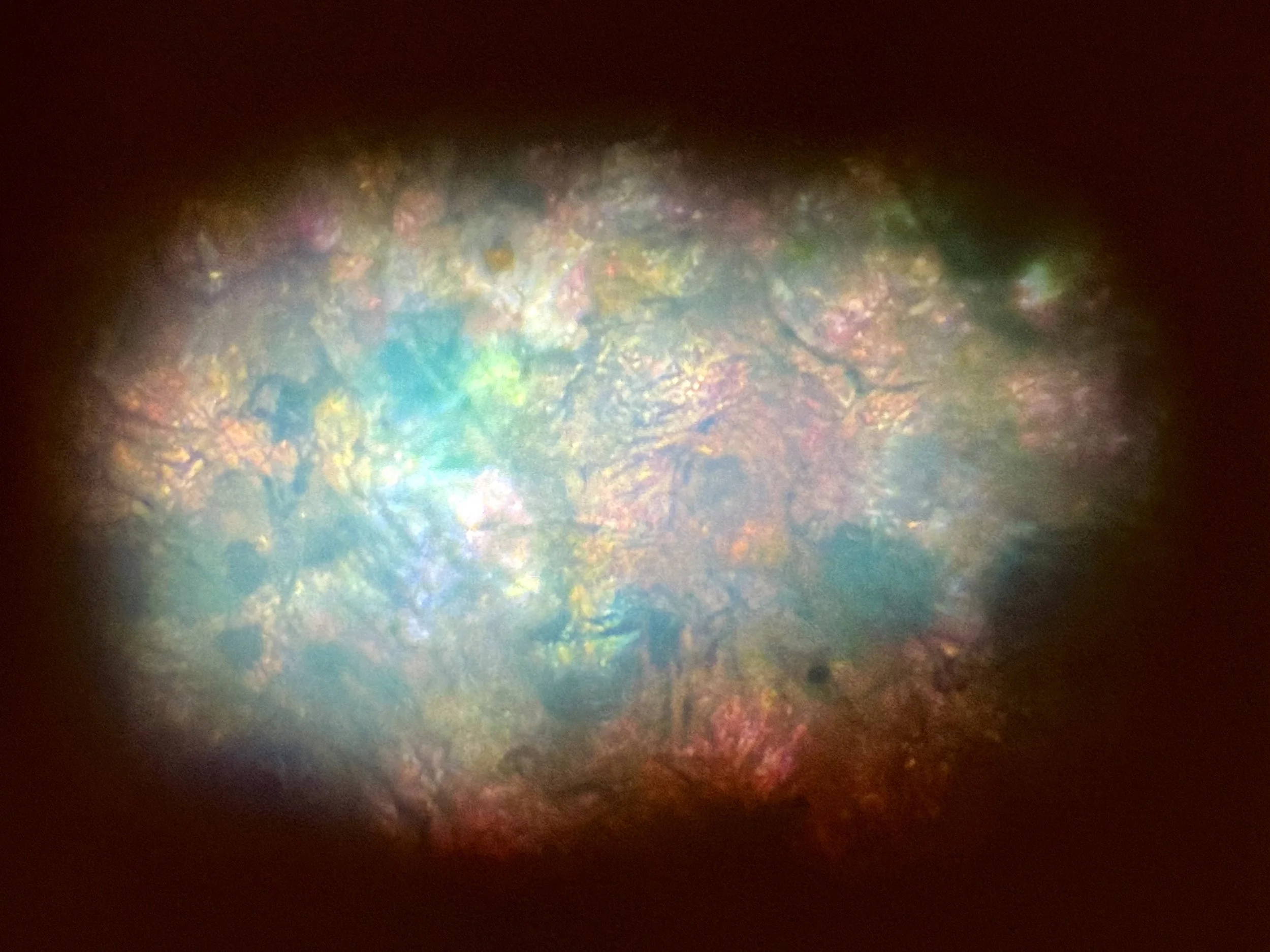 Katina Bitsicas: MicroMortality