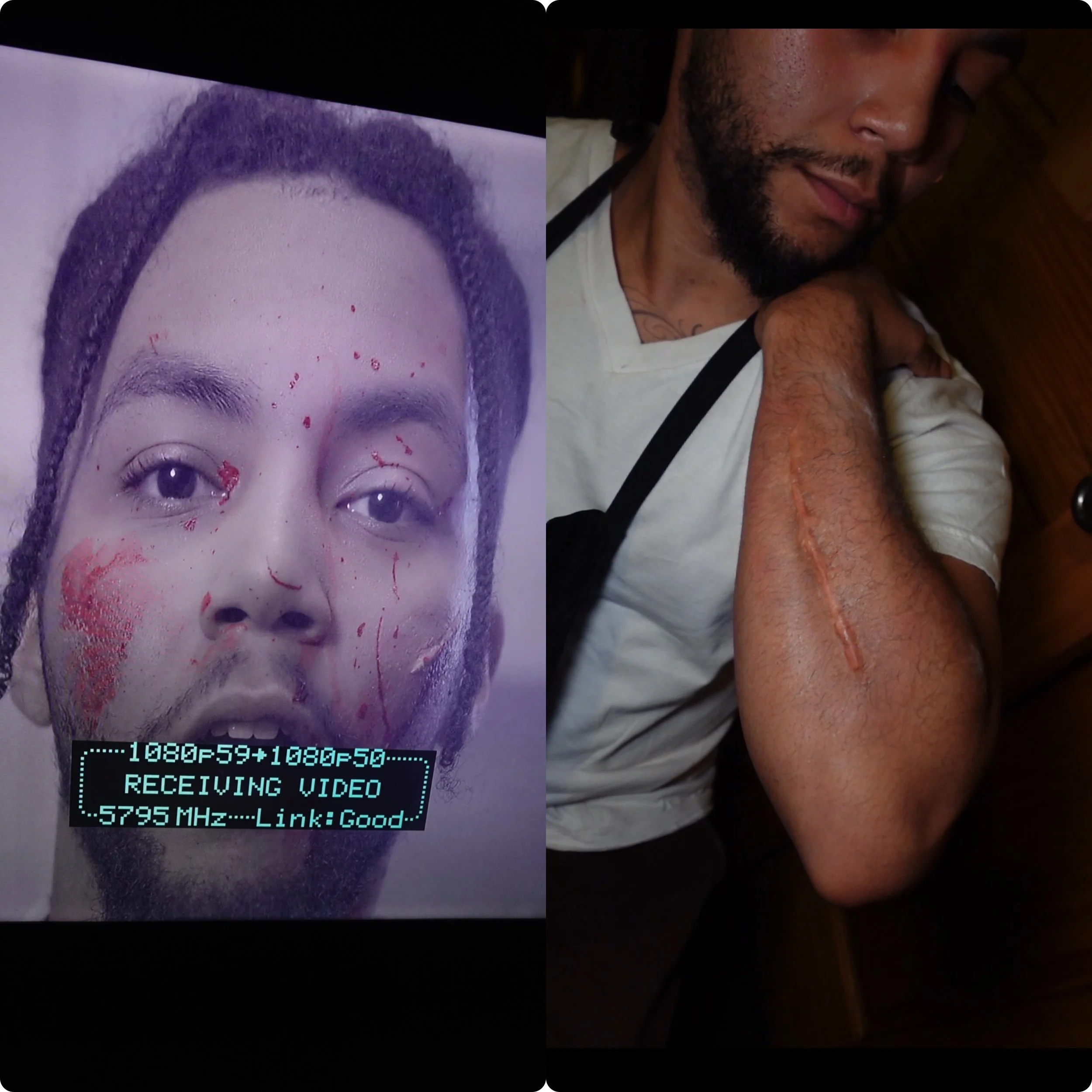 Body Music Video (SFX Scars)