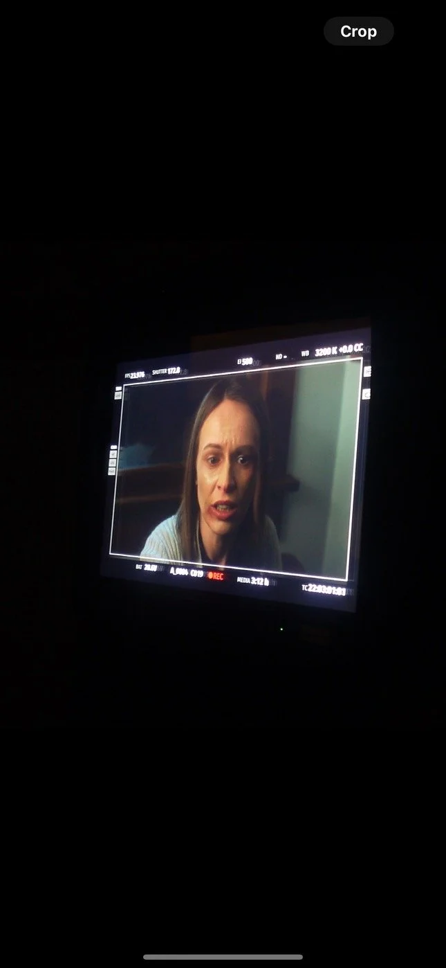 Liz- Donut SFX Bruises