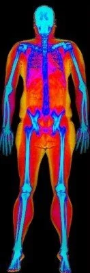 A client undergoing a gold-standard DEXA body composition scan at Health InSight LLC in Layton, Utah, measuring body fat percentage and bone density.