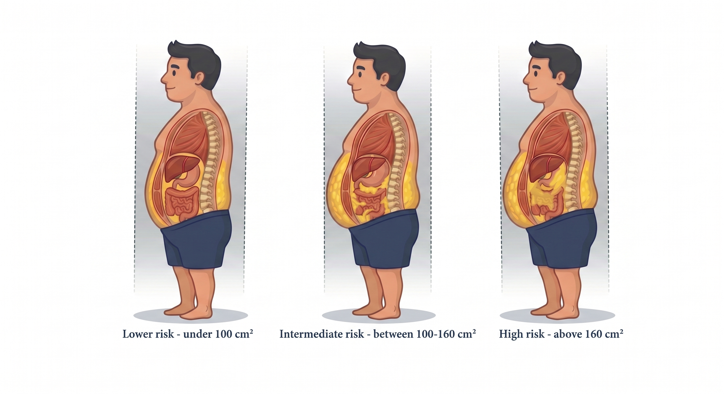 Anatomical illustration comparing three men with low, medium, and high amounts of internal visceral fat surrounding their abdominal organs, highlighting hidden metabolic health risks