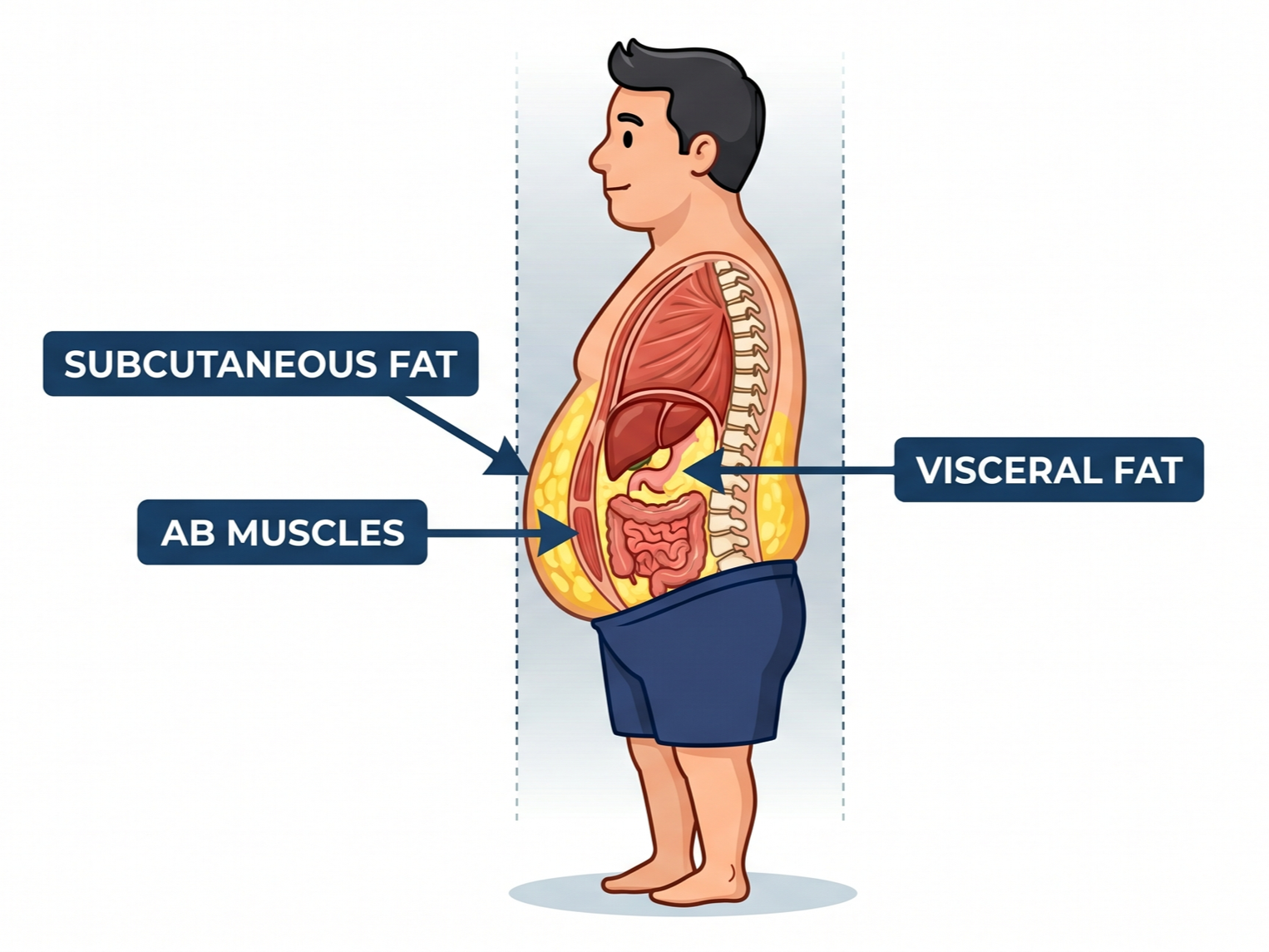 Anatomical cross-section diagram illustrating the difference between subcutaneous fat located directly under the skin and dangerous visceral fat stored deep around the abdominal organs