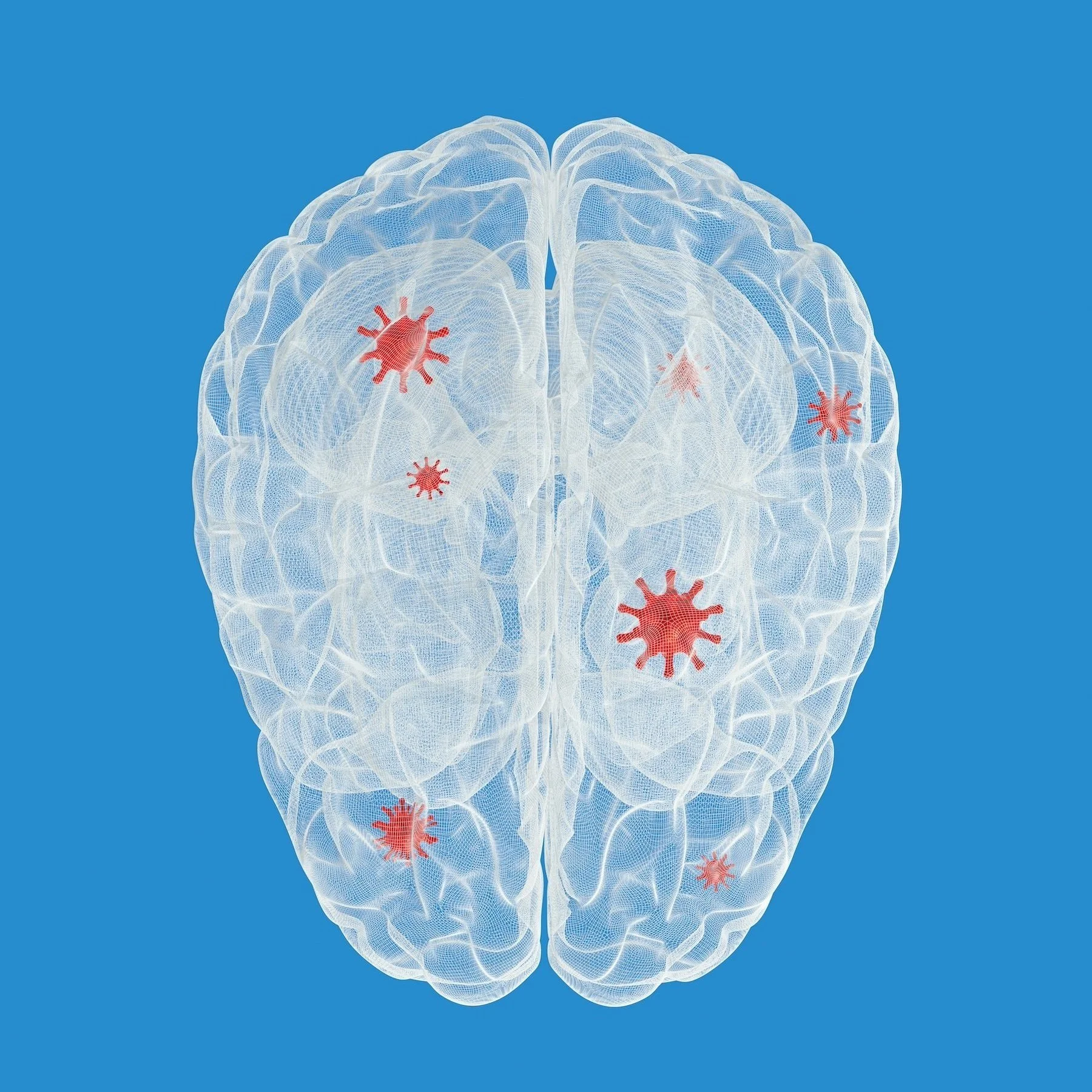 Does Exercise Help Parkinson's Disease