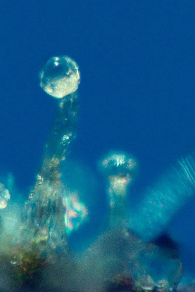 Frank_Capitate Stalked Resin Gland_Thai Stick_Photomicrograph X100, 1979