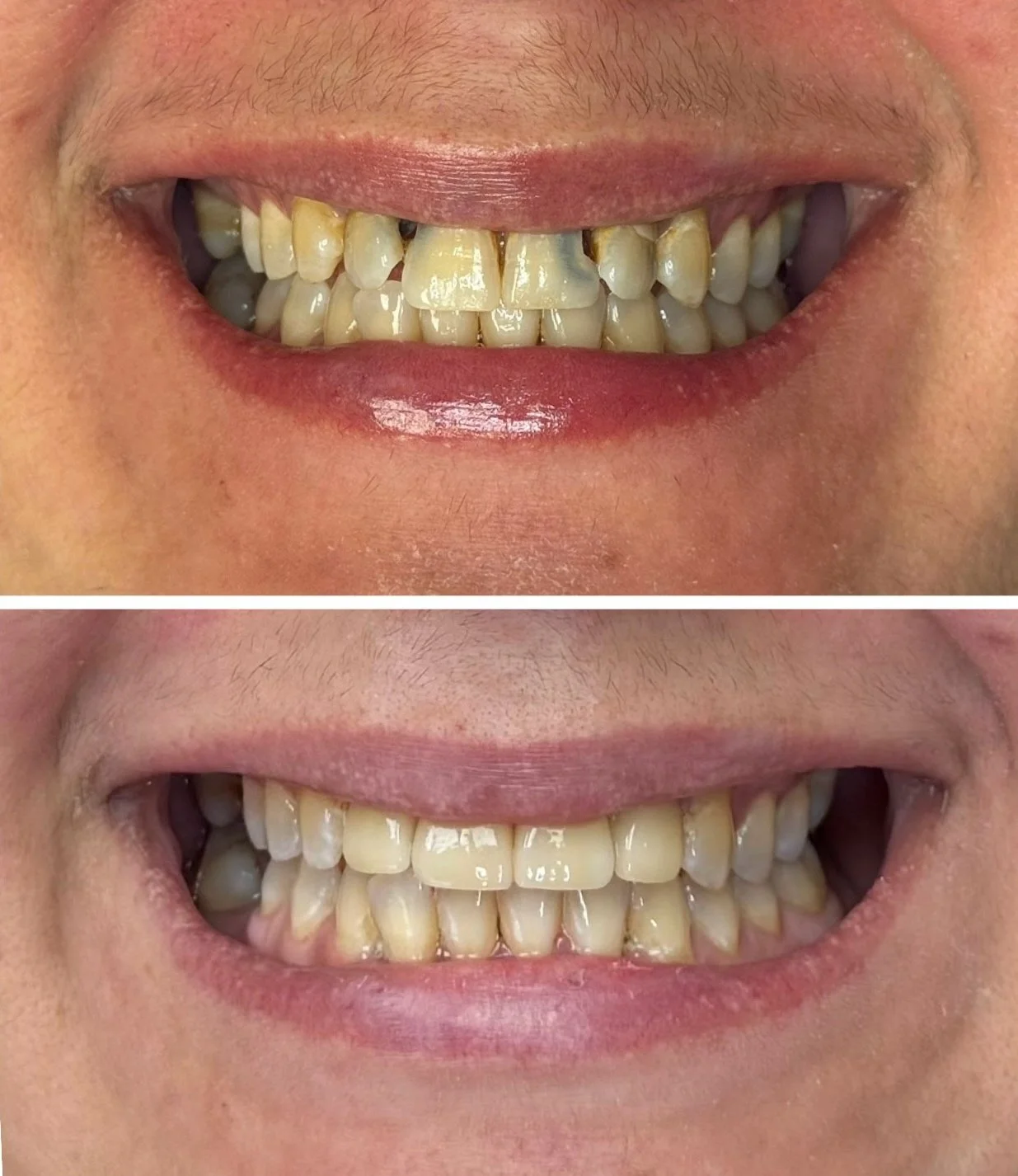 Fixed Prosthodontics