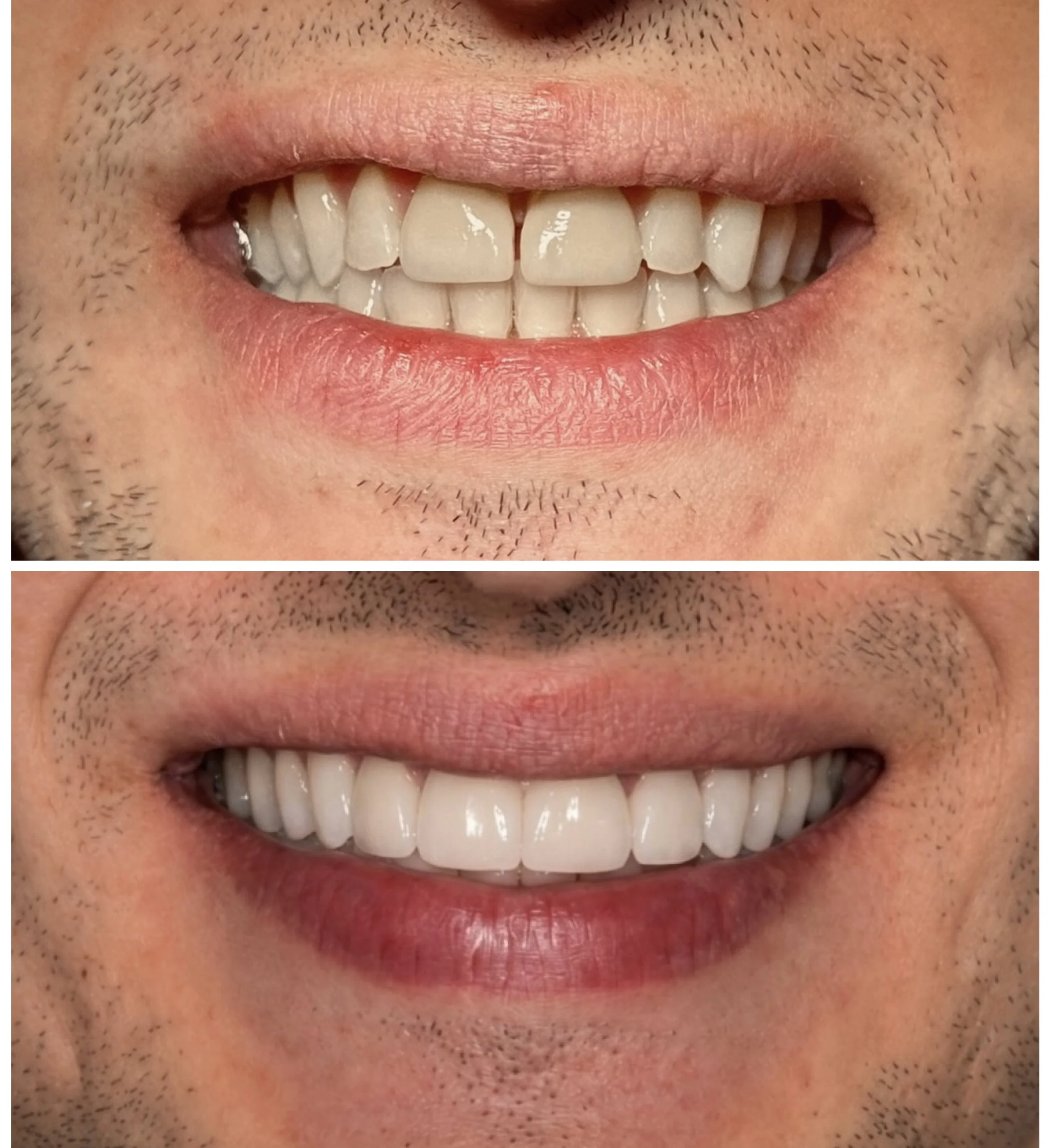 Fixed Prosthodontics