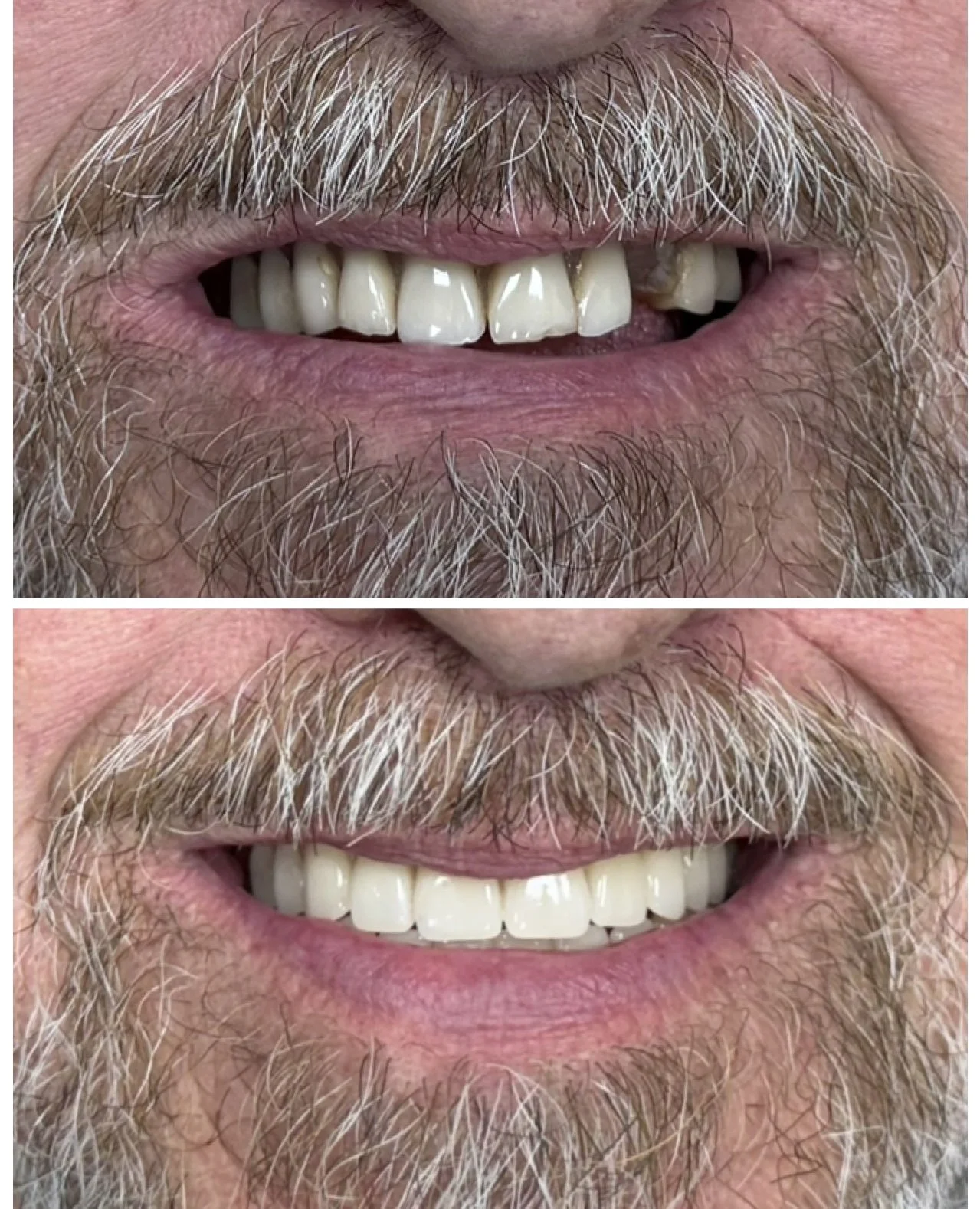 Removable Prosthodontics