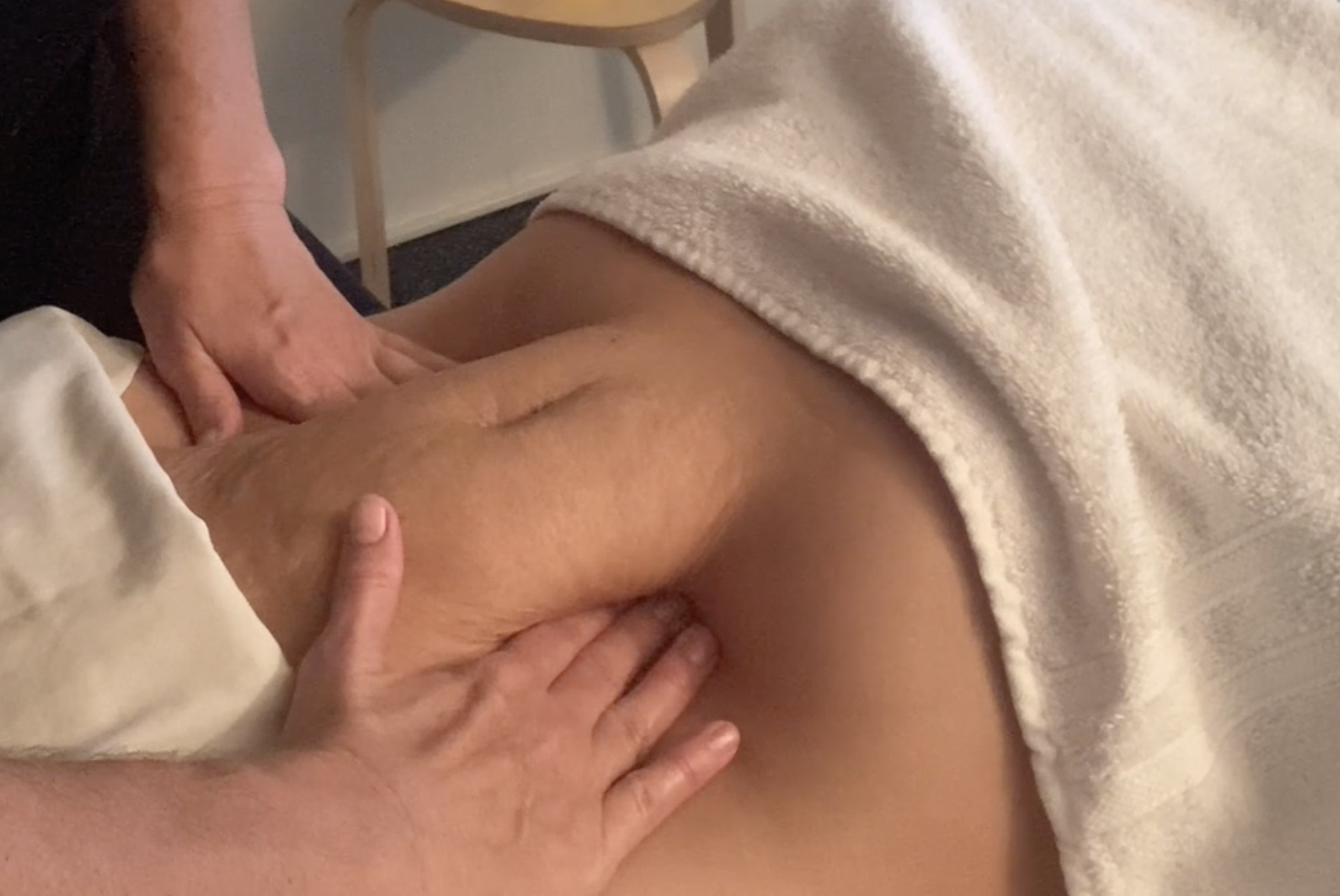 PP belly rectus lift.png