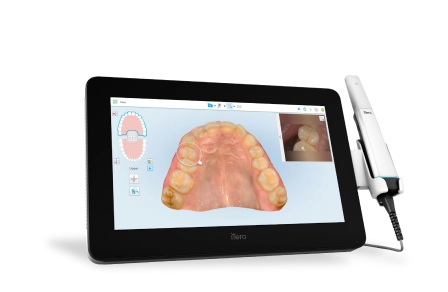 Dental intraoral scanner displaying a 3D model of a patient's upper teeth and gums, with a close-up inset of a tooth on the screen.