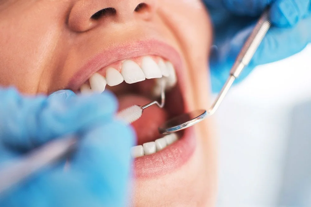 Close-up of a person receiving a dental examination or cleaning, showing their open mouth with dental tools and a dentist's hand wearing a blue glove.