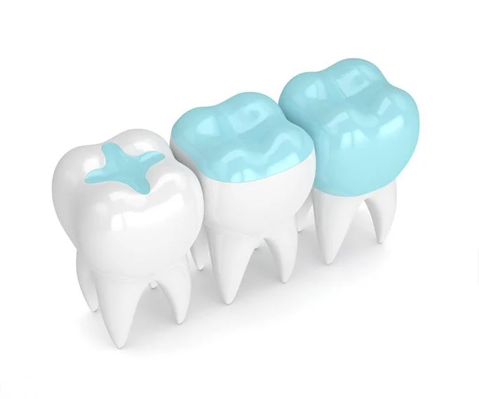 Three large cartoon-style molar teeth with blue filling, arranged in a row.