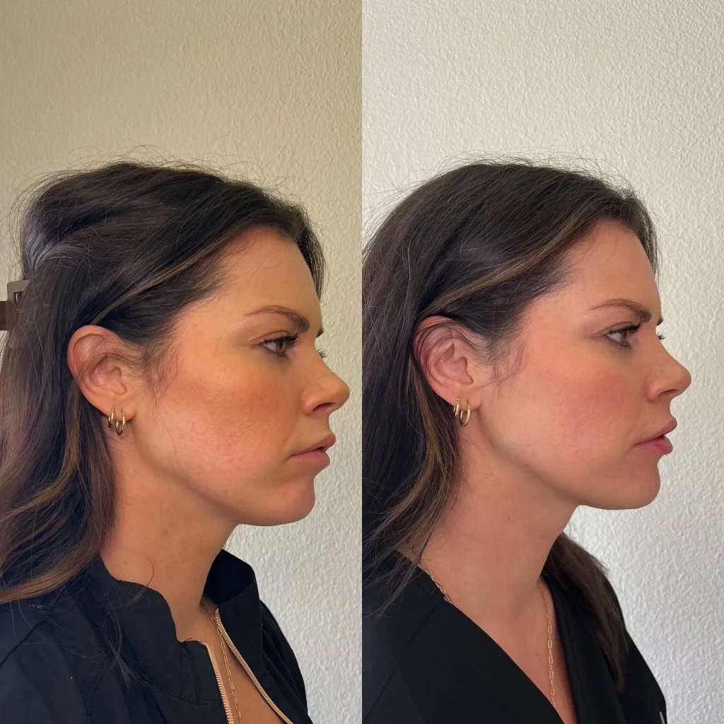 Skin Rejuvenation Treatments