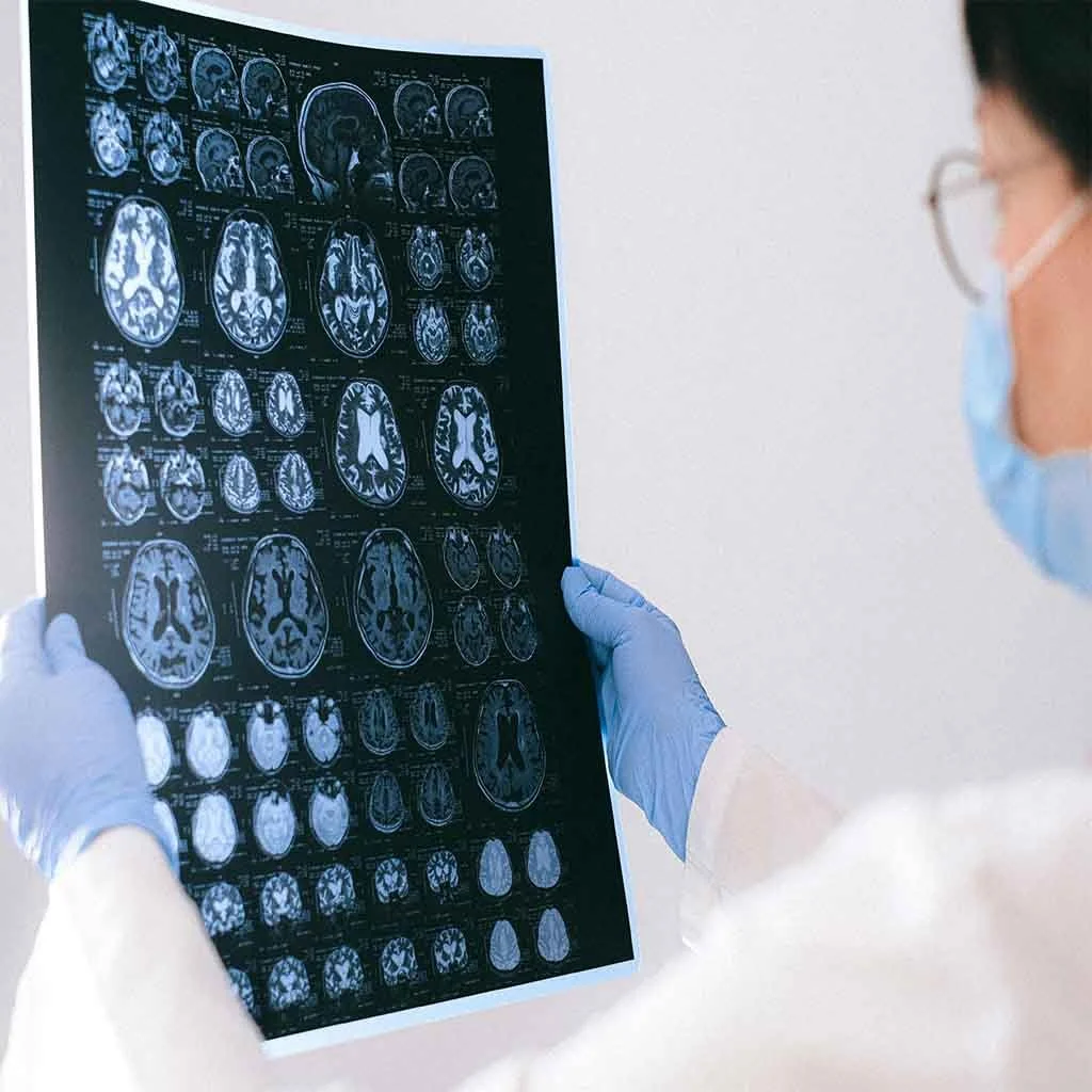 Understanding Traumatic Brain Injury — Century Psychology Group