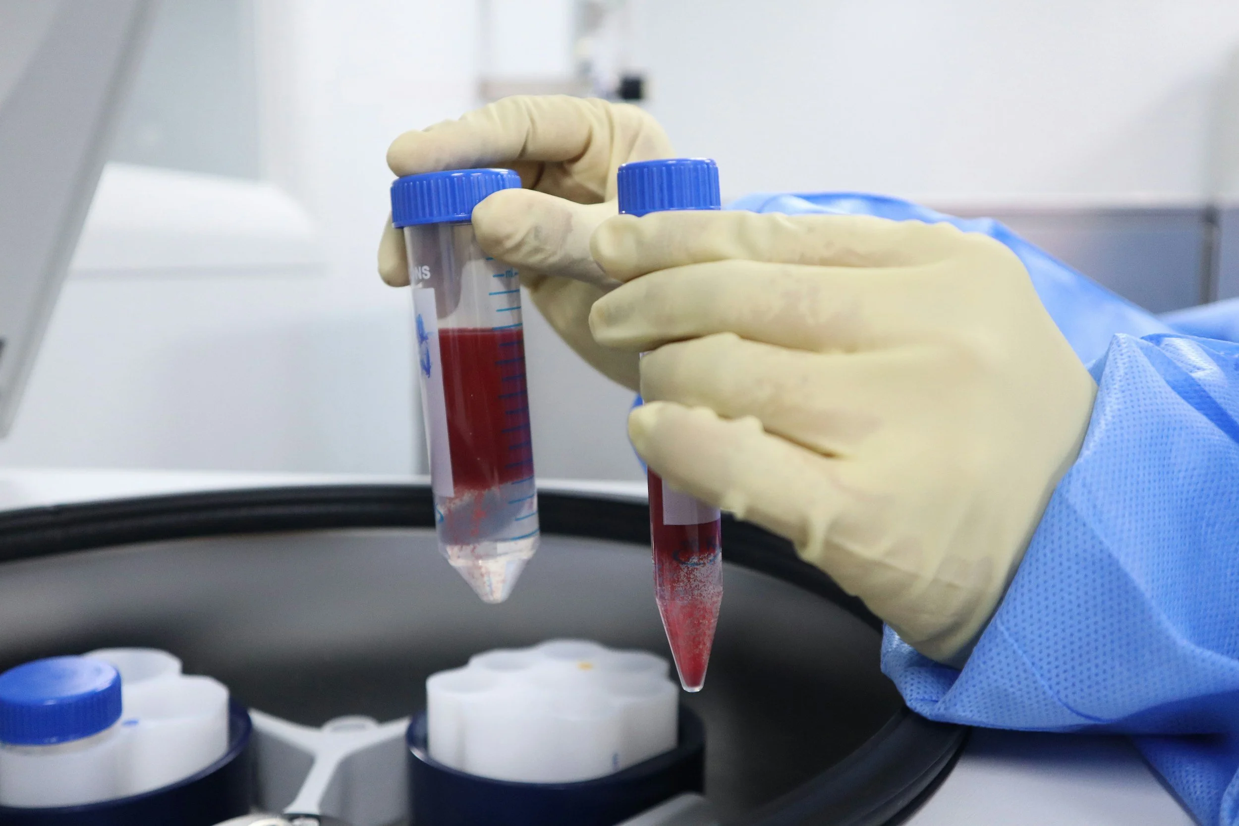 A scientist wearing yellow gloves and a blue lab coat holding two small test tubes filled with a red liquid in a laboratory setting.
