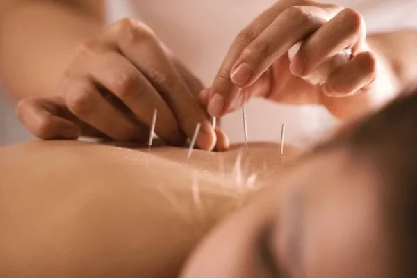 Acupuncture services are back at WHPC! Welcome Guna - Registered Acupuncturist