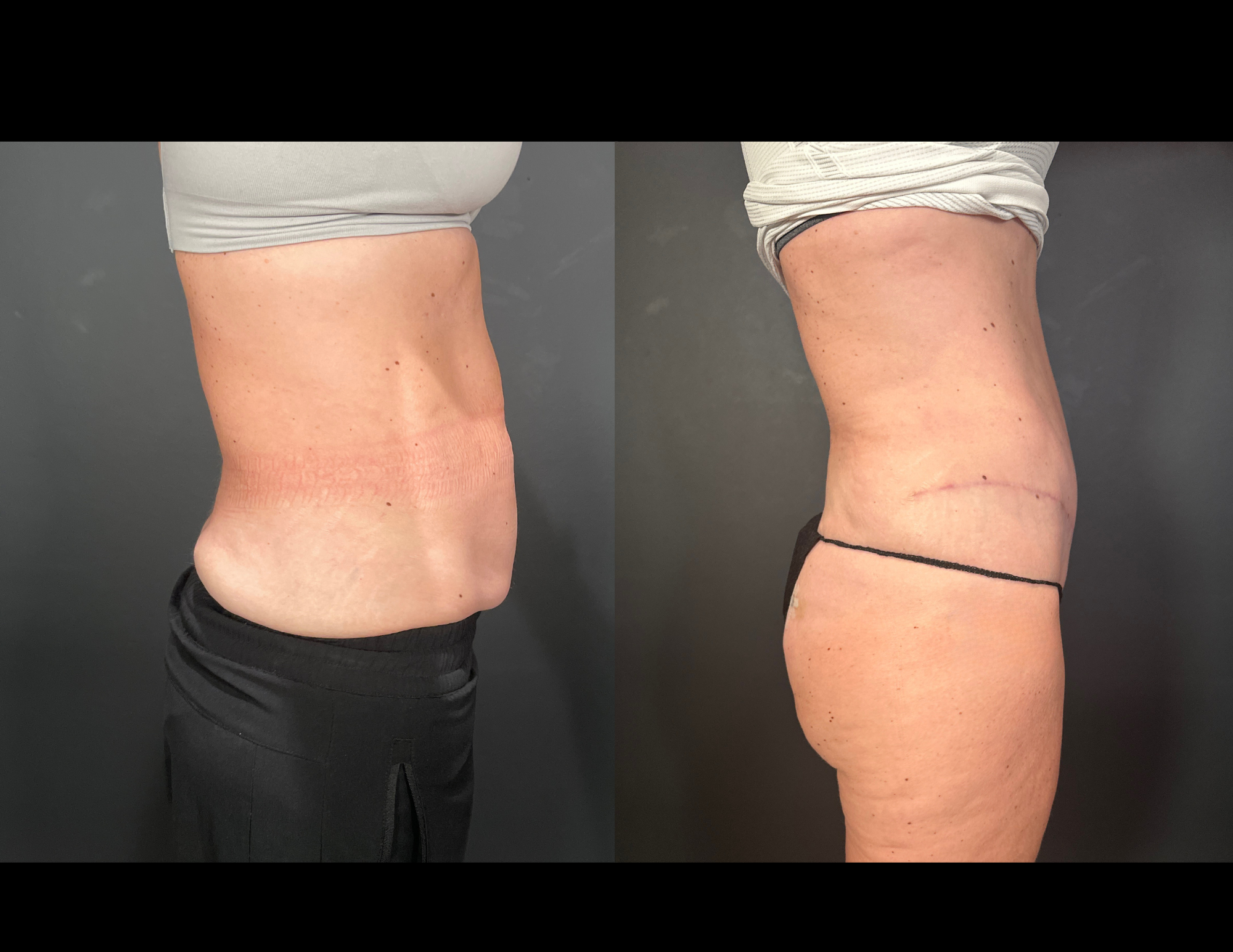 Before & After Photos (20).png