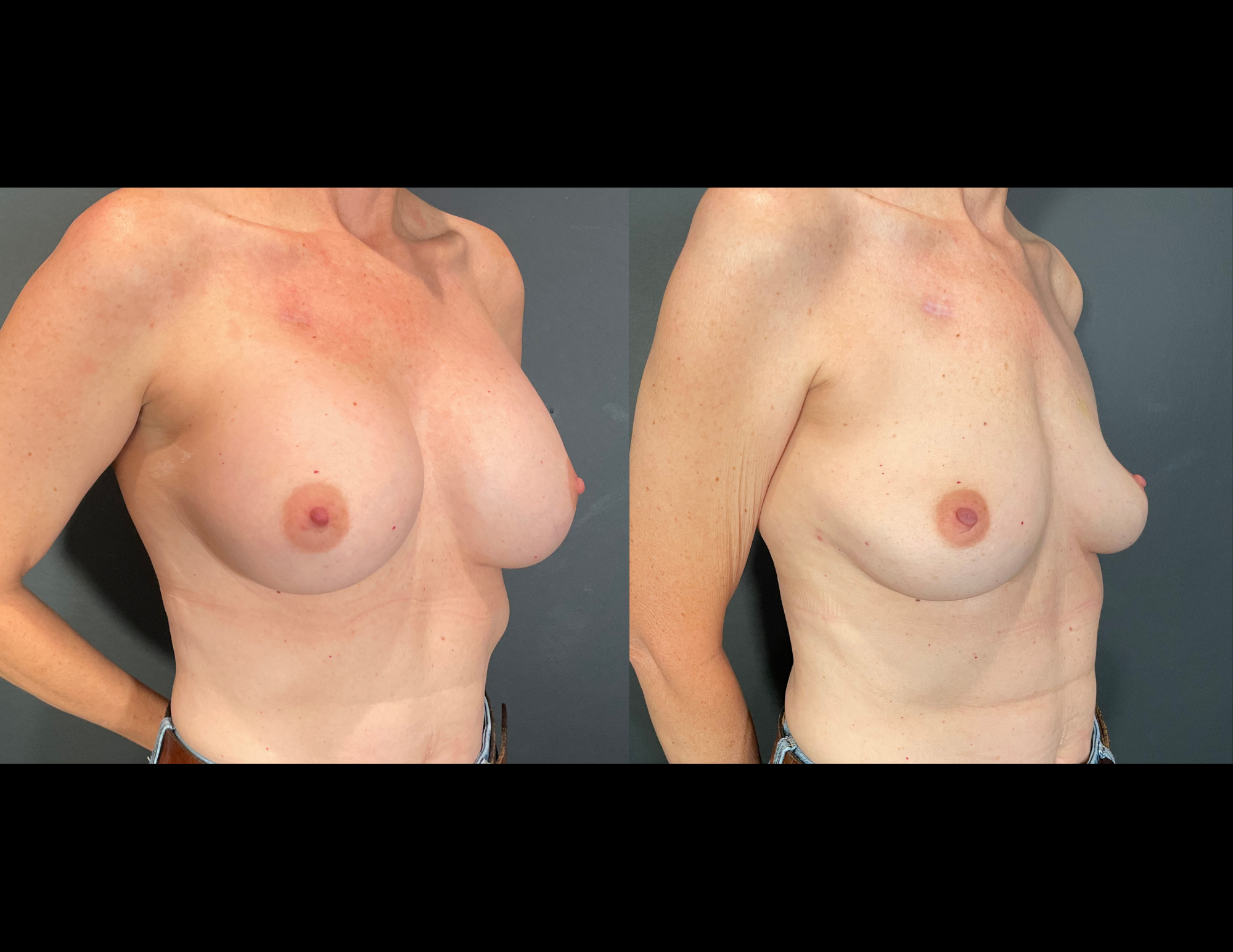 Before & After Photos (59).png