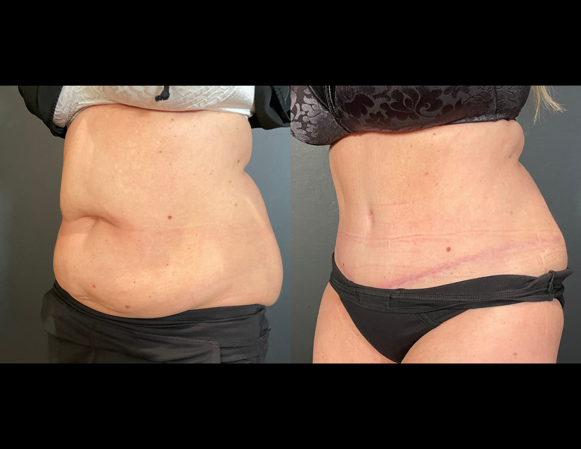 Before & After Photos (30).png