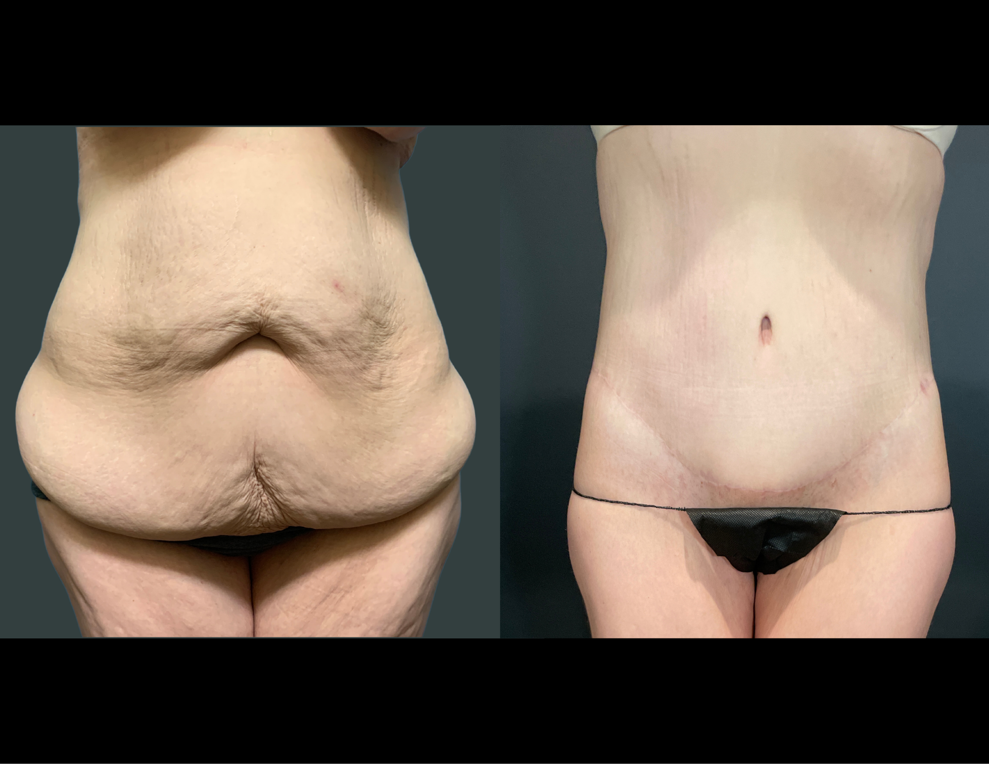 Before & After Photos (41).png