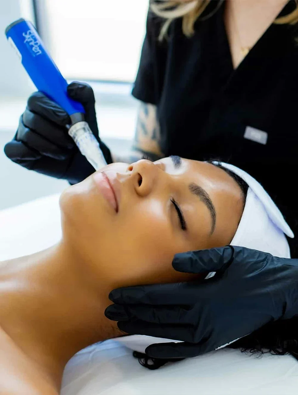 SkinPen Microneedling - Face