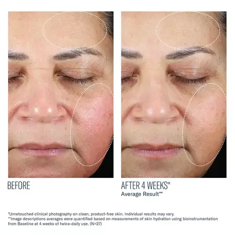 PDP_Trio Luxe_BeforeAfter_Rev2545.webp