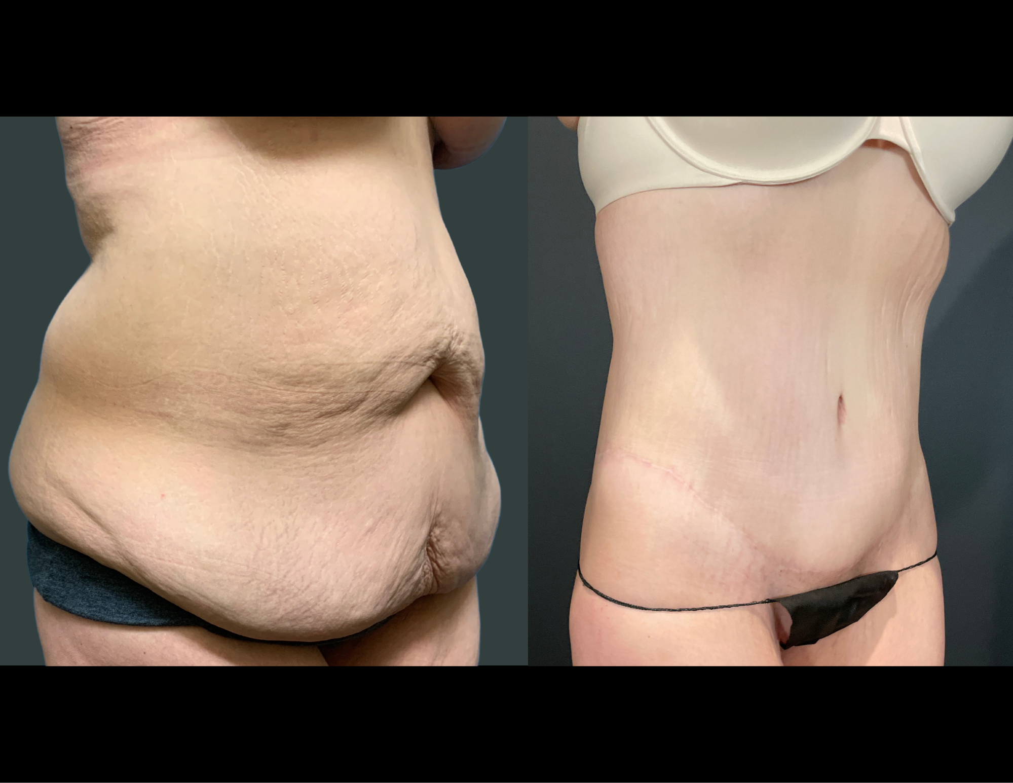 Before & After Photos (39).png