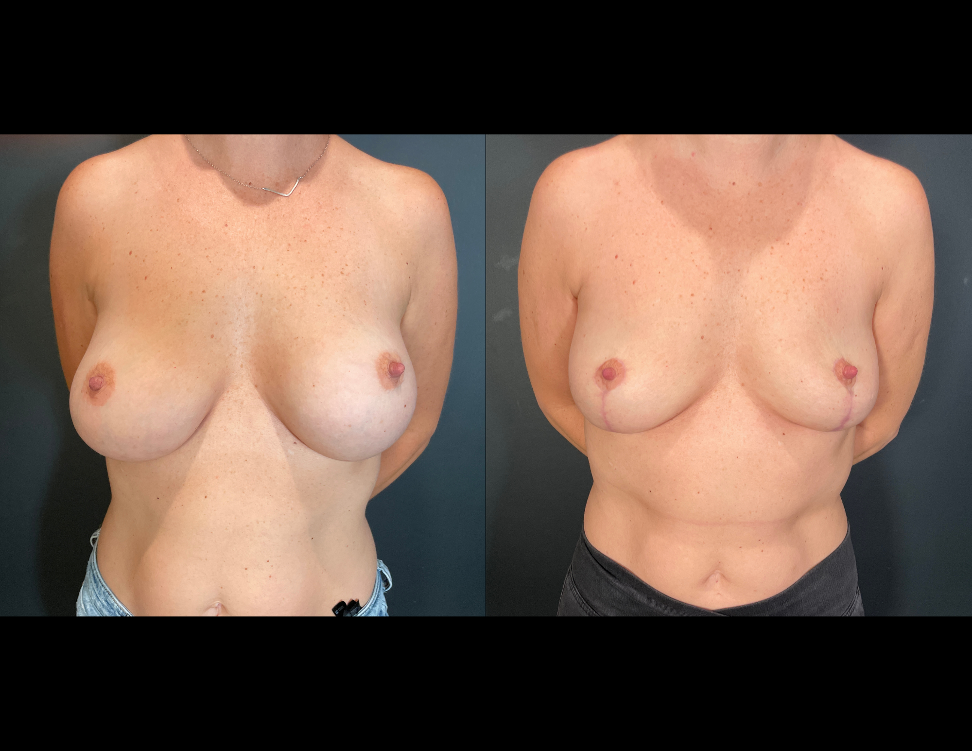Before & After Photos (49).png