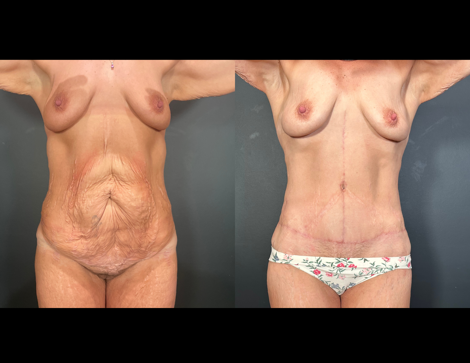 Before & After Photos (7).png