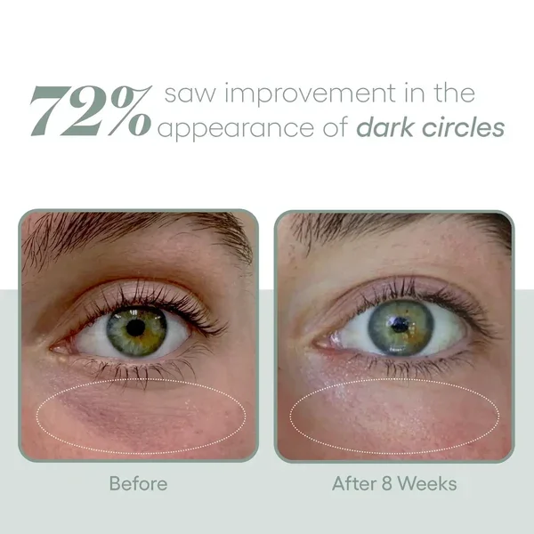 Exosome_EYE_Serum_Plated-4.webp
