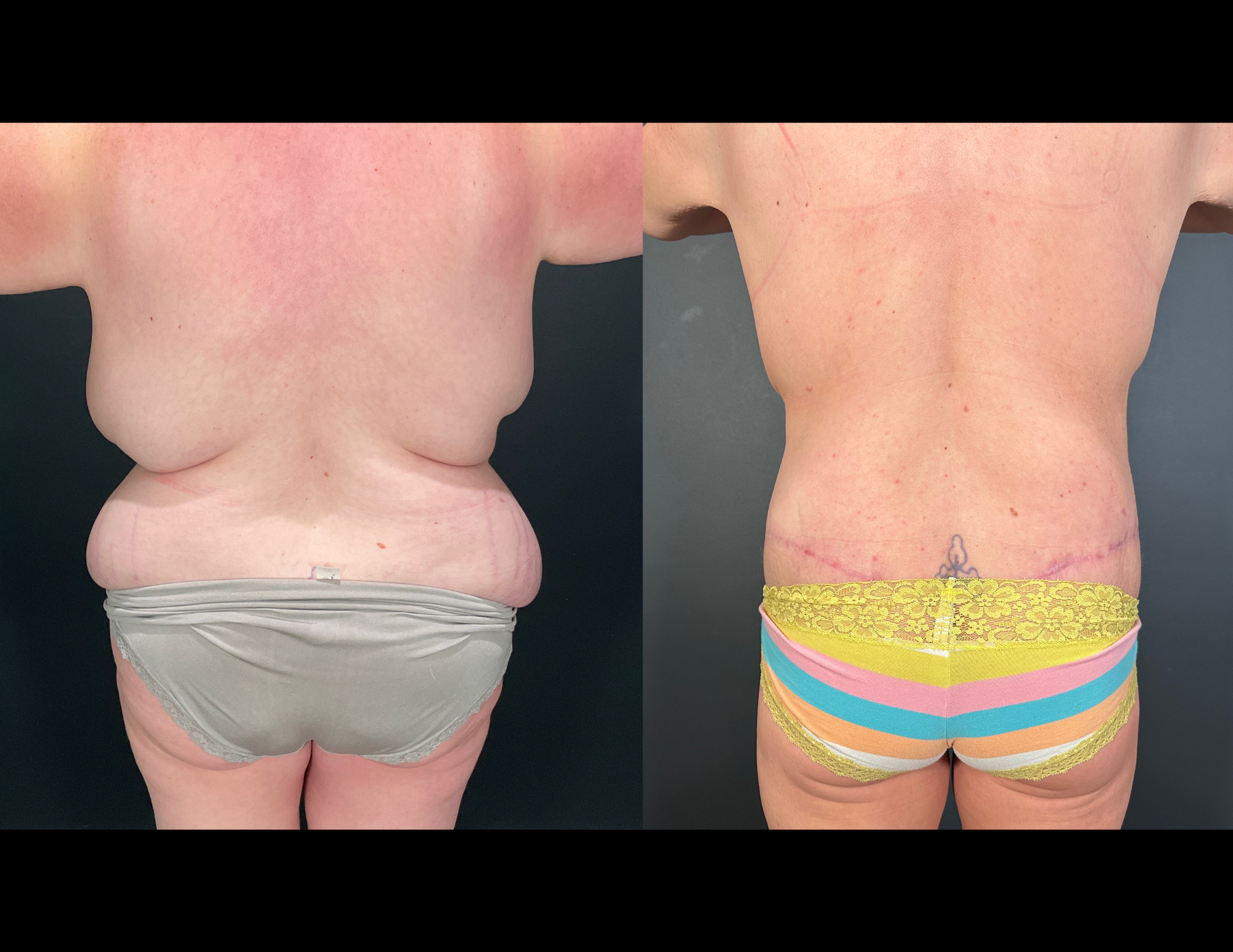 Before & After Photos (35).png