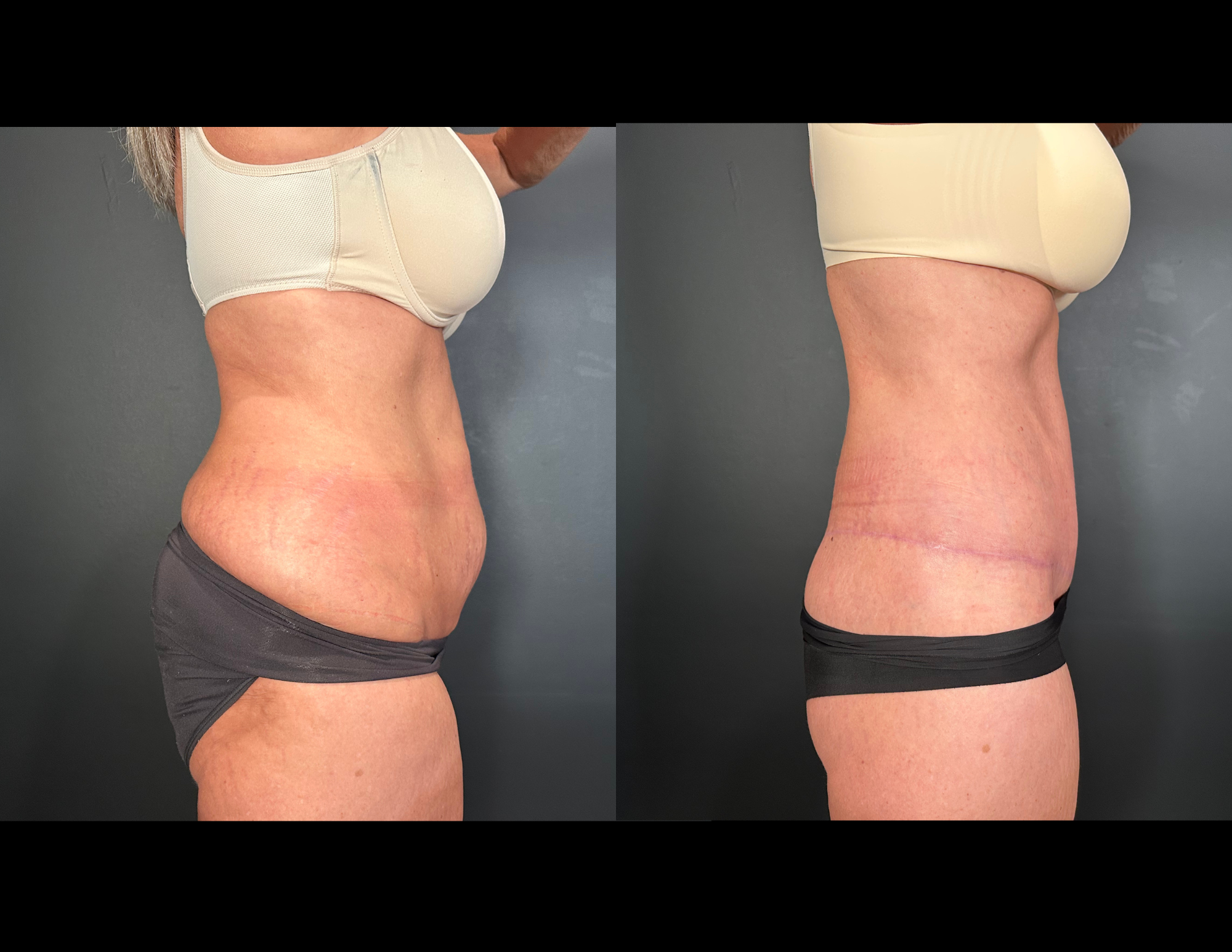 Before & After Photos (4).png