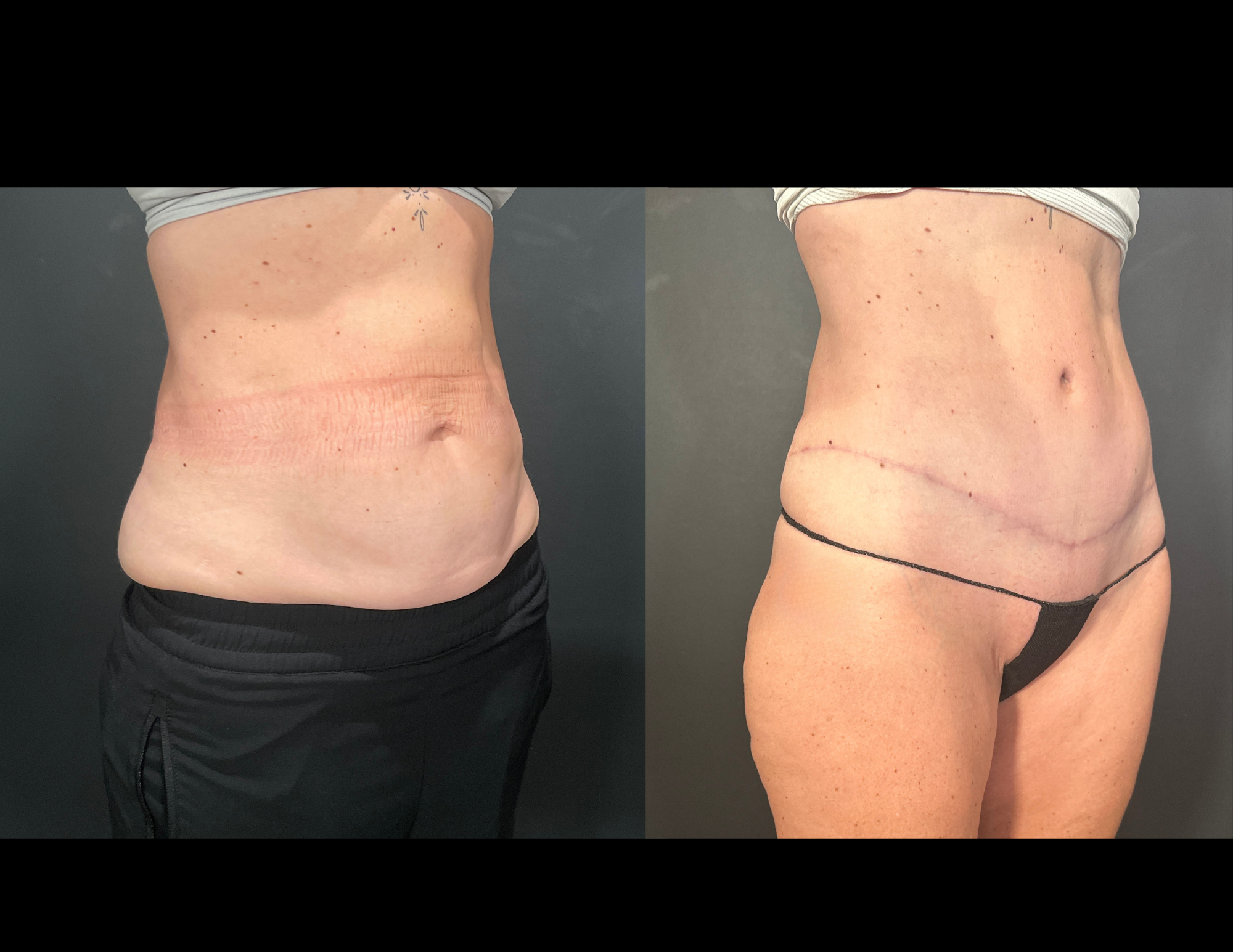 Before & After Photos (16).png