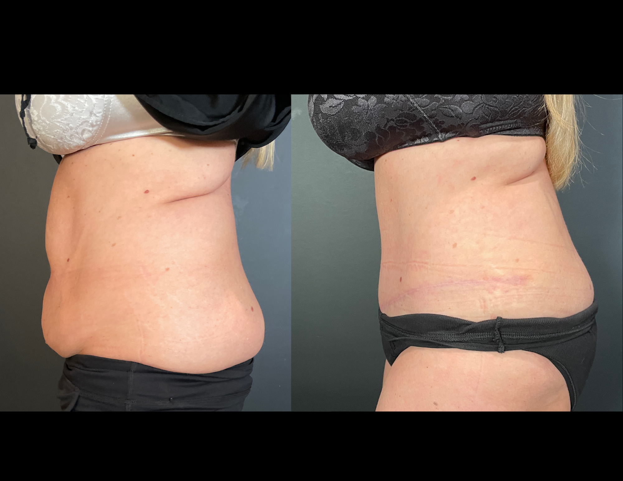 Before & After Photos (33).png