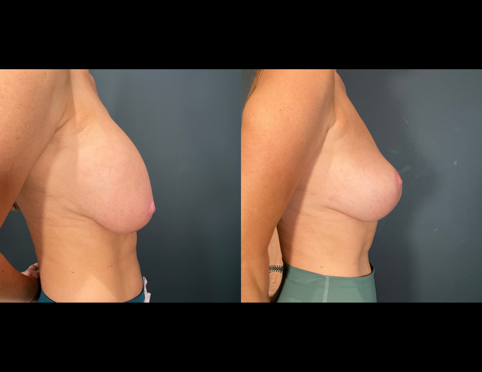 Before & After Photos (48).png