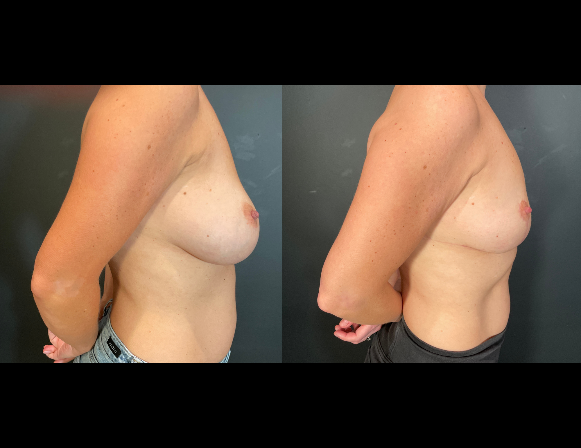Before & After Photos 2(51).png