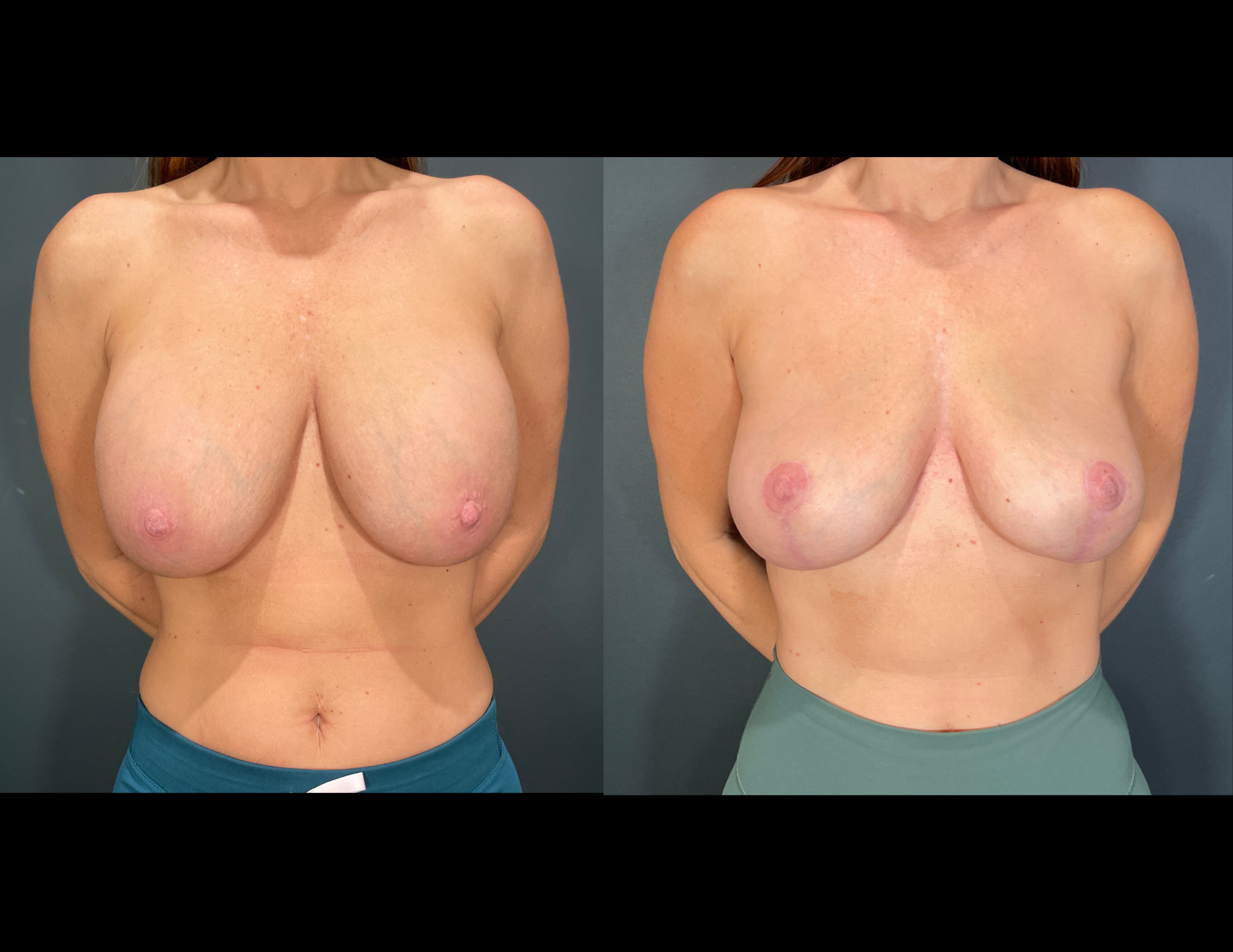 Before & After Photos (45).png