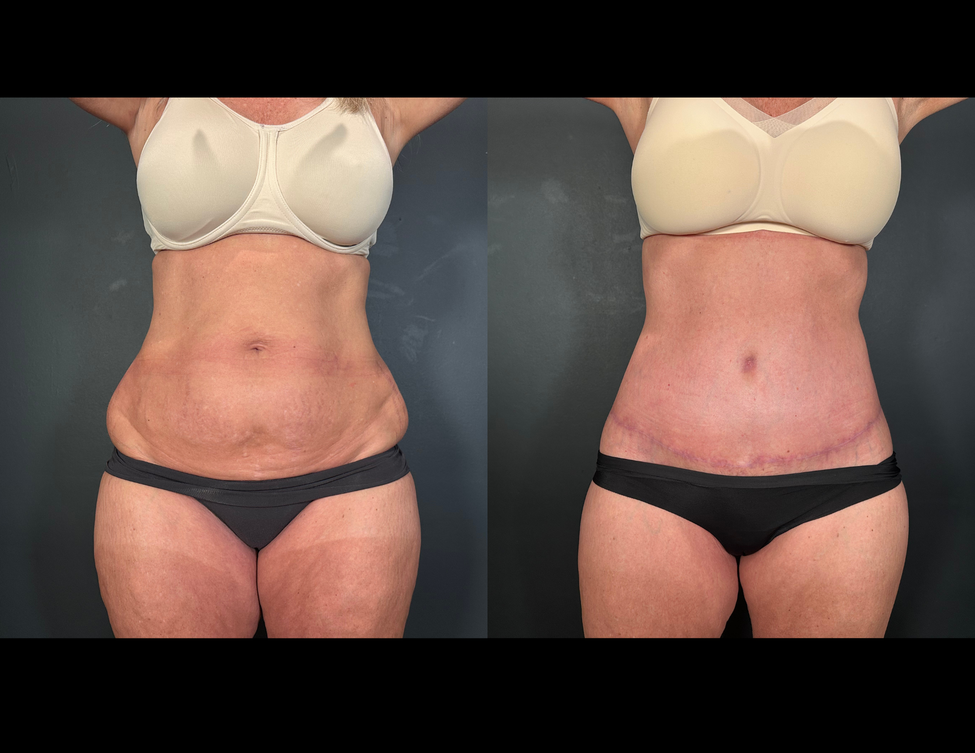 Before & After Photos (1).png