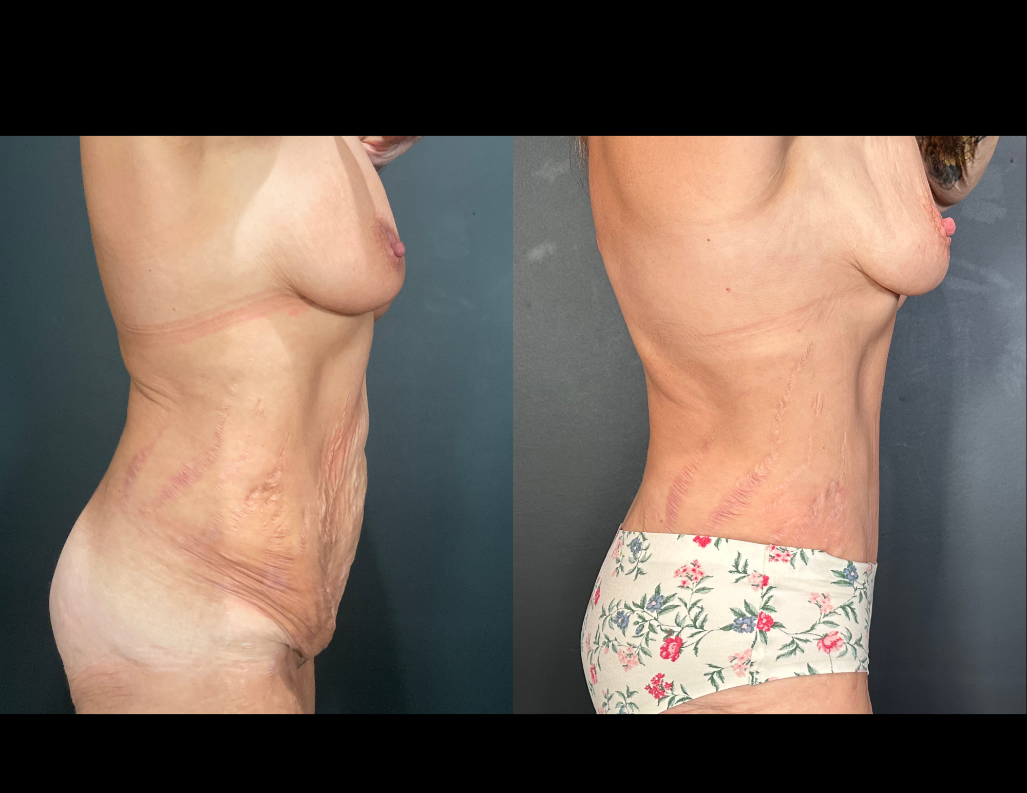 Before & After Photos (8).png